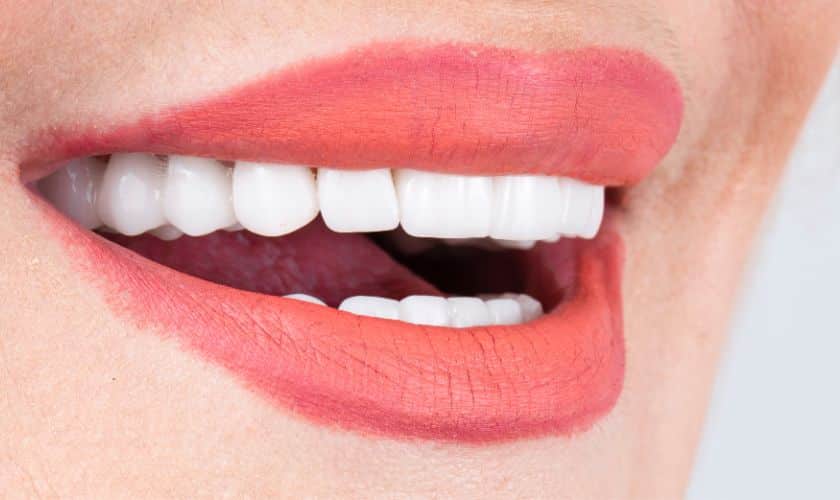 Four Benefits Of Dental Veneers